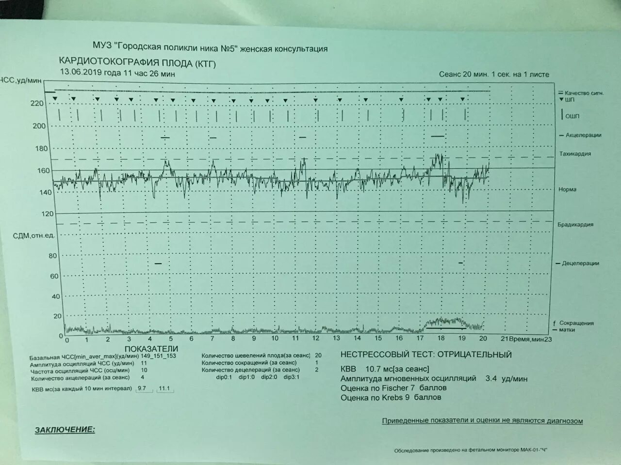 Нормы по КТГ В 35 недель беременности. Нормальная диаграмма КТГ. КТГ-мониторинг алгоритм. Шевеления на 35 неделе