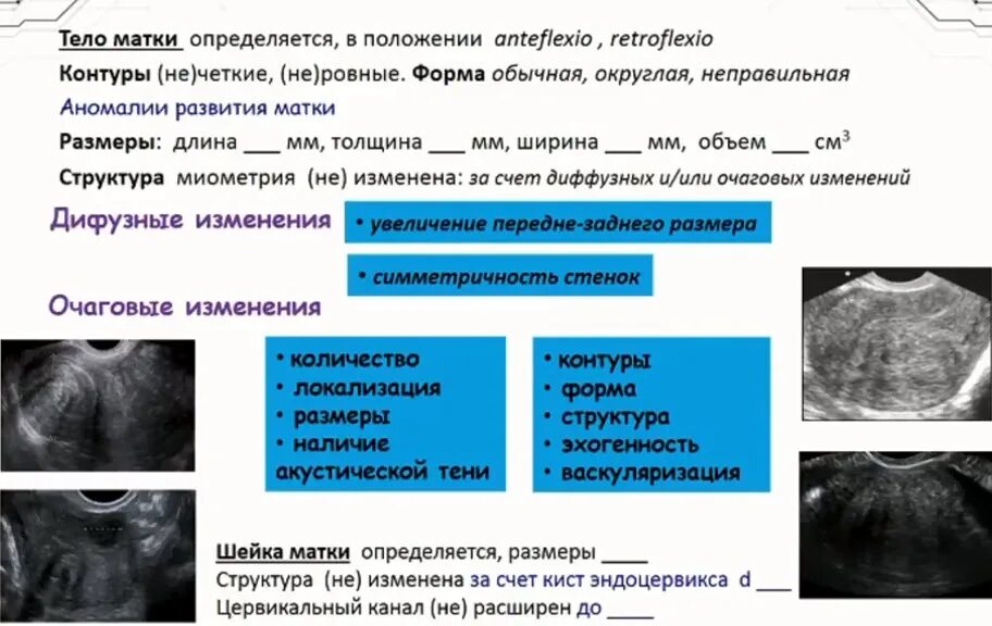 Диффузные изменения структуры миометрия. Миометрий норма на УЗИ.