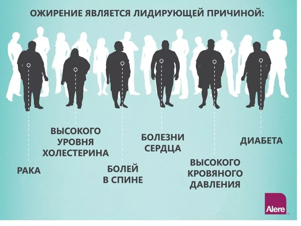 Схема ожирения. Причины развития ожирения.