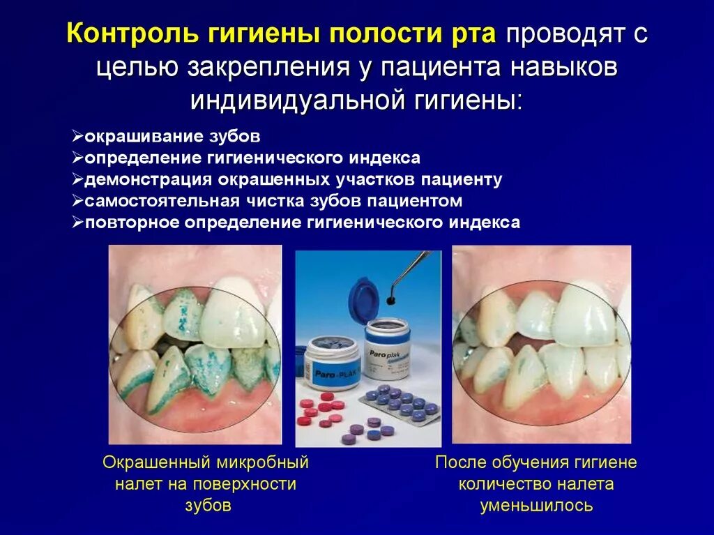 Этапы гигиены полости рта. Профессиональная гигиена полости рта, методика выполнения.. Средства для проведения профессиональной гигиены полости рта. Методы и средства профессиональной гигиены полости рта. Контролируемая гигиена полости рта.