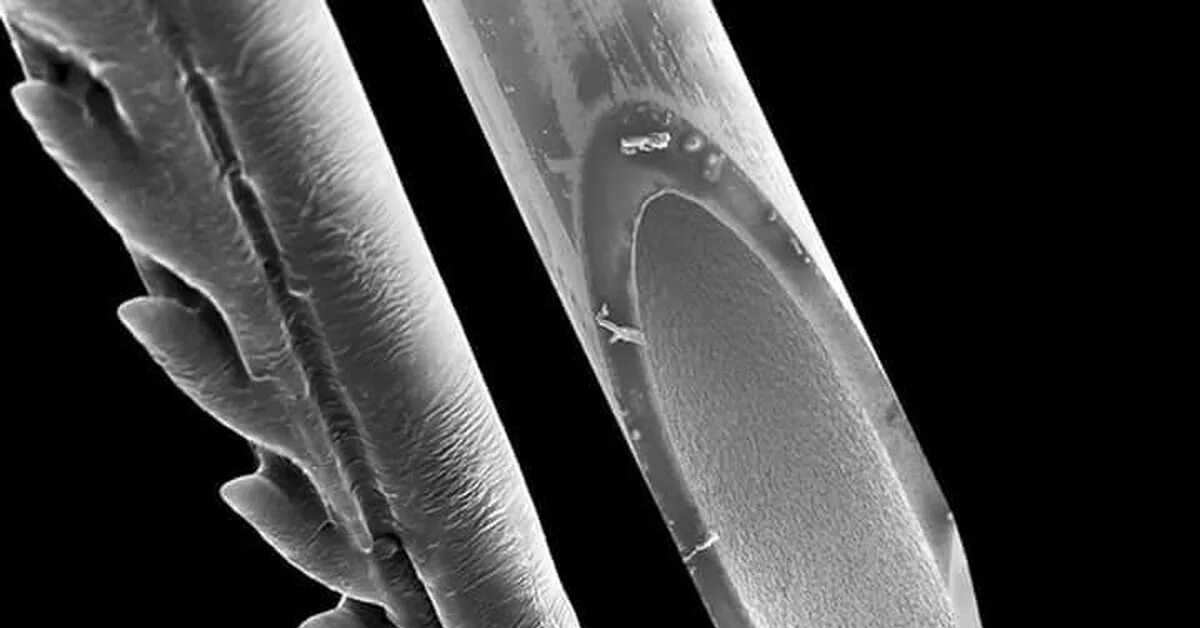 Игла после использования. Жало пчелы под микроскопом и иголка. Игла под микроскопом. Жало пчелы под микроскопом.