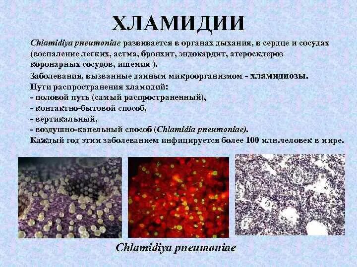 Типы хламидий. Хламидии морфология микробиология. Chlamydia pneumoniae морфология. Хламидии по типу дыхания. Тип дыхания хламидий.