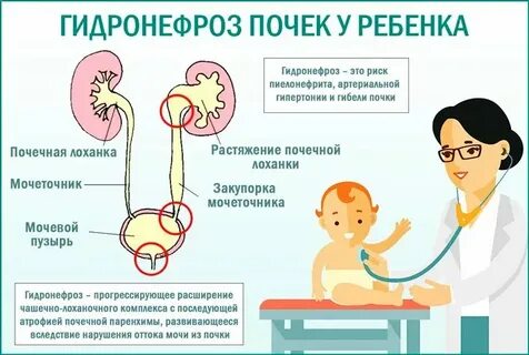 Тесты гидронефроз по утвержденным клиническим рекомендациям 2023