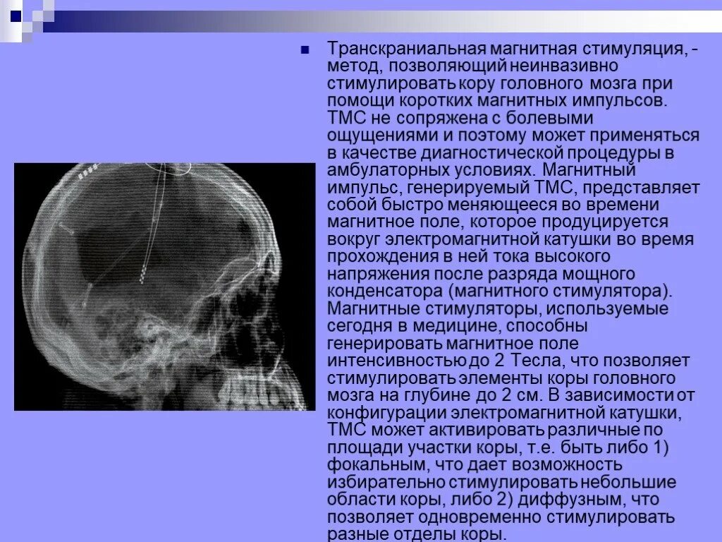 Стимуляция мозга ребенка. Магнитная стимуляция ТМС. Методика транскраниальной магнитной стимуляции. Транскраниальная магнитная стимуляция мозга. ТМС транскраниальная магнитная стимуляция.