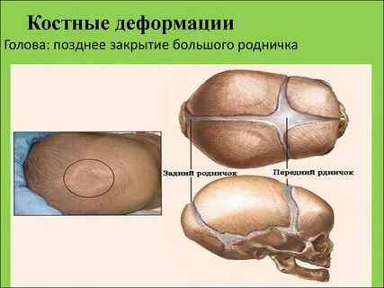 Когда зарастает темечко у ребенка