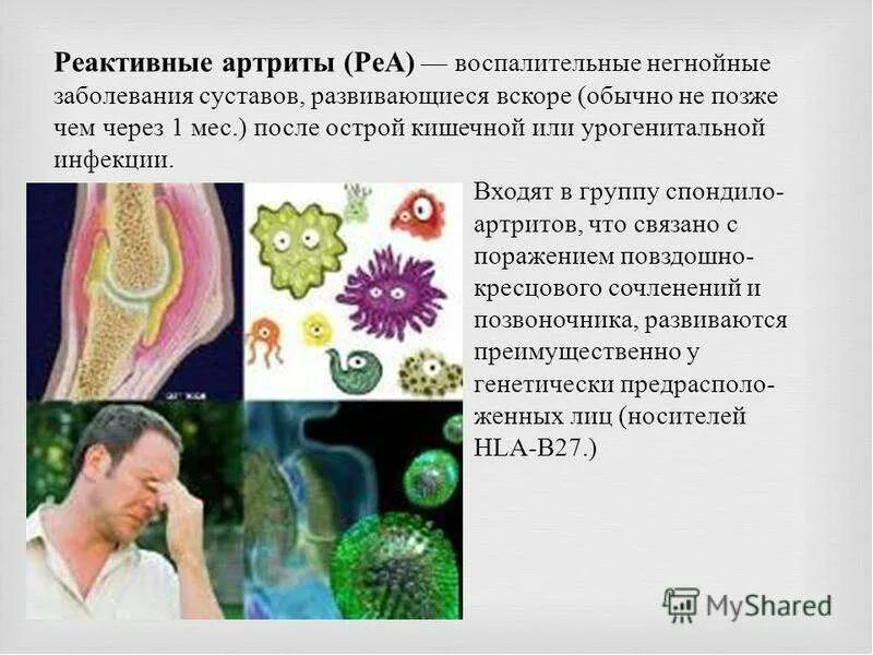Инфекция поражает суставы