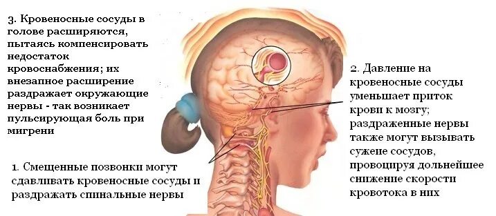 Ощущения в голове что шевелится. Болит голова. Боль при мигрени. Пульсирующие боли в голове.