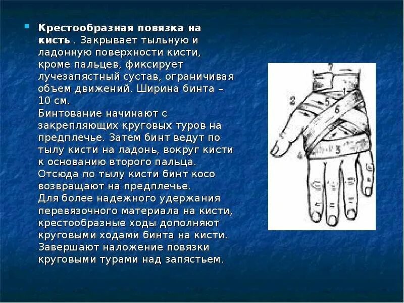 Крестообразная повязка