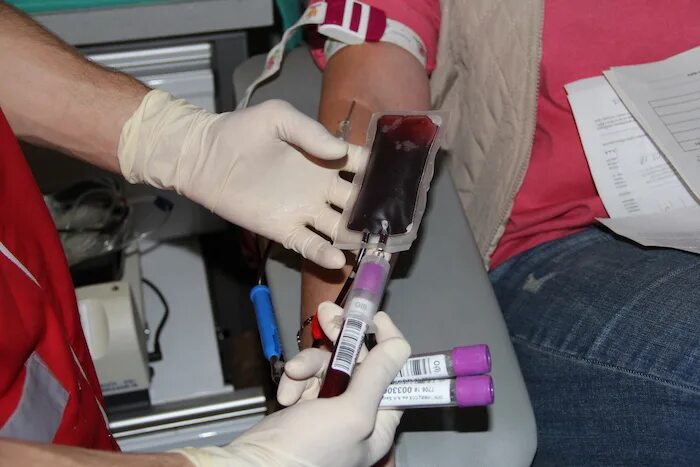 Плазма крови донорство. Как можно сдать плазму крови