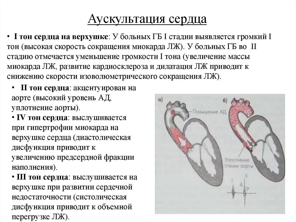 Норма форма сердца. Тоны сердца в норме при аускультации. 1 Тон при аускультации сердца. 3 Тон аускультации сердца. Аускультация патологических тонов сердца.