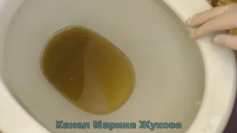 Очистить унитаз от камня уксусом