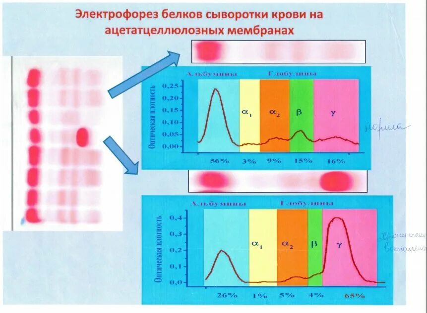 Соотношение белковых фракций методом электрофореза. Соотношение белковых фракций методом электрофореза