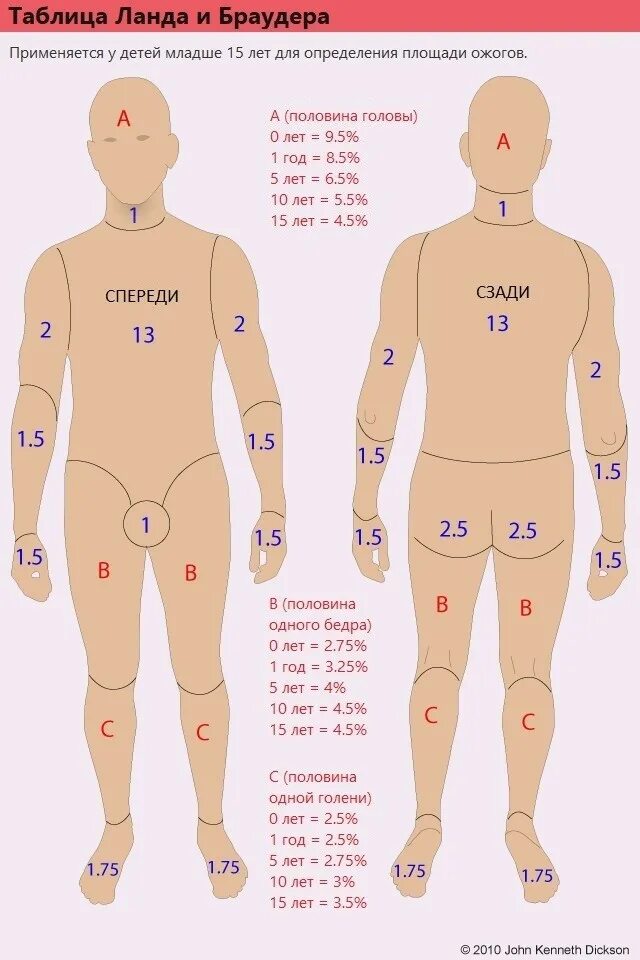 Площадь поражения при ожогах. Ланда Броудера. Таблица Ланда и Броудера. Таблица Ланда Броудера ожоги. Таблица Лунда-Браудера.