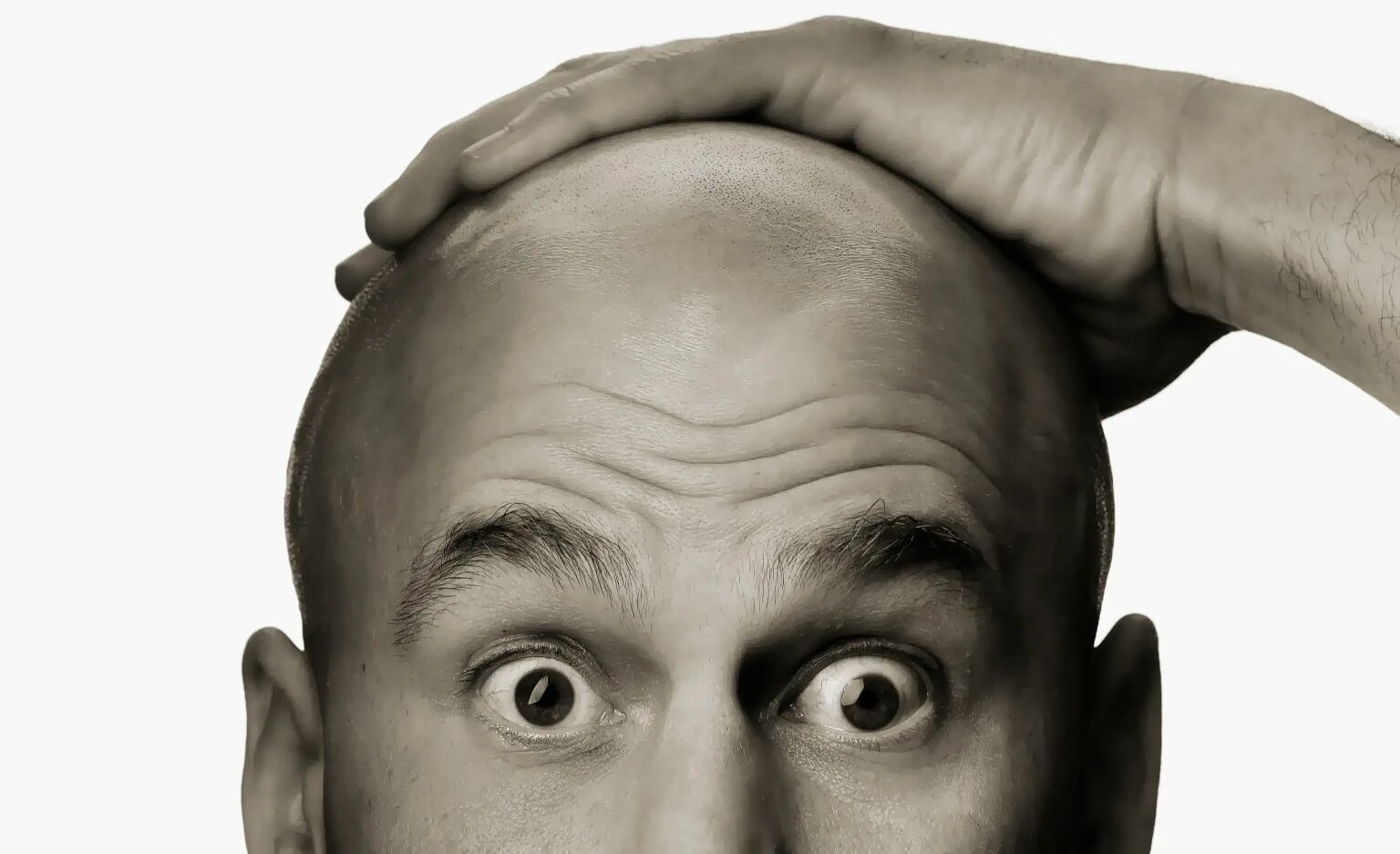 Лысая мужская голова. Лицо человека. Лысые головы мужчин. Лысая голова. Обычная башка.