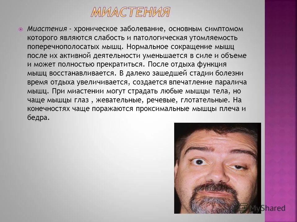 Миастения у после 60 лет симптомы. Миастения характеризуется. Осложнения миастении. Основной симптом миастении. Миастения неврология.
