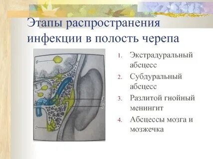 Лечение гнойных абсцессов