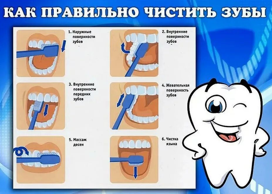 Почему после стоматолога нельзя есть 2 часа. Памятка как чистить зубы для детей. Алгоритм правильной чистки зубов. Схема чистки зубов для детей. Алгоритм как правильно чистить зубы для детей.