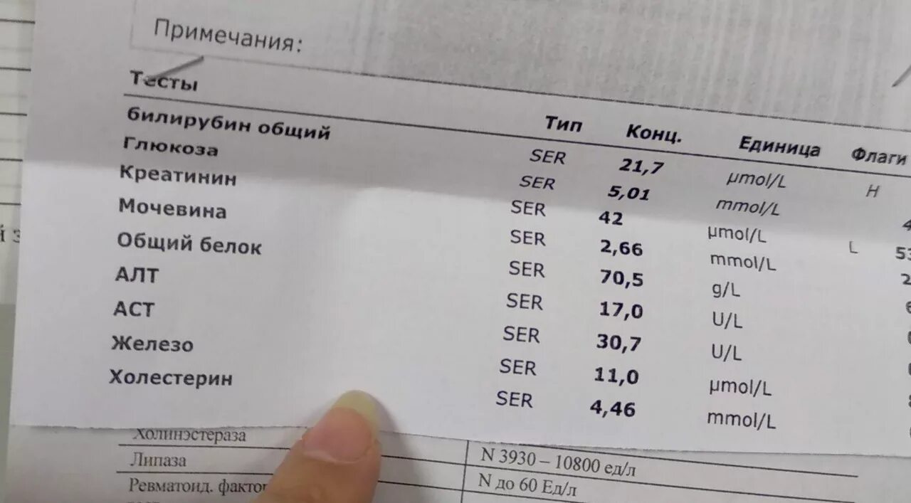 Повышен билирубин прямой в крови у мужчины. Билирубин анализ. Анализ билирубин общий норма. Билирубин общий норма у детей 5 лет. Нормальные показатели билирубина крови.