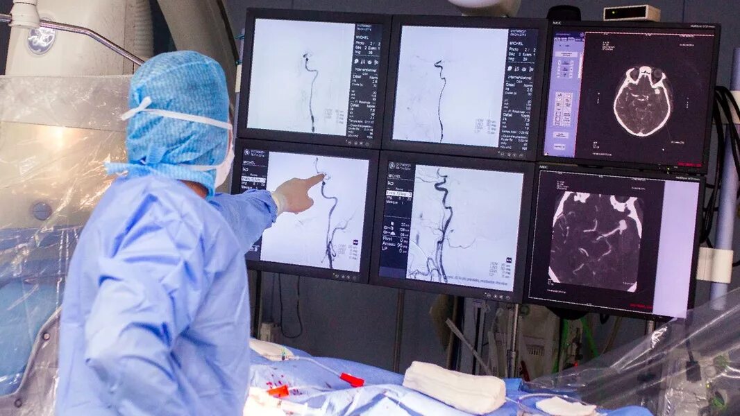 врач по сосудам головного мозга