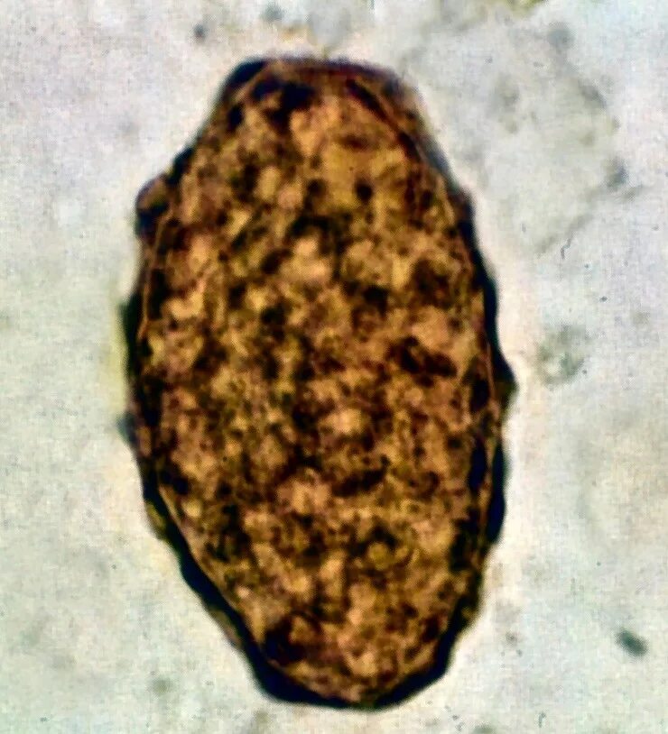Сколько человек в кале. Неоплодотворенное яйцо аскариды. Яйца гельминтов Ascaris lumbricoides. Ascaris lumbricoides яйца микроскоп.