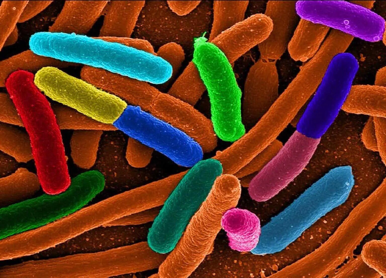 Микроорганизмы кишечная палочка. Болезнетворные бактерии кишечная палочка. Модифицированные микроорганизмы. Генетически модифицированная микроорганизмы. Живые микроорганизмы.