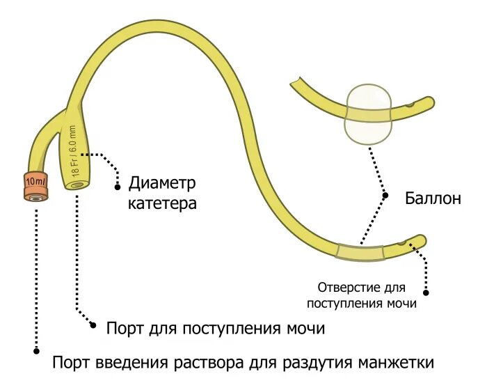 Как правильно ставить катетер