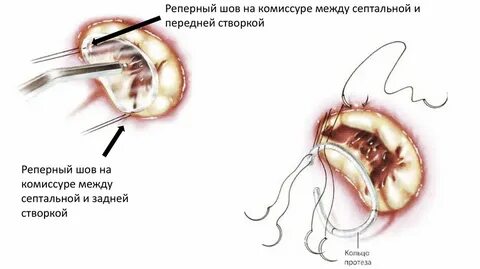 По де ли