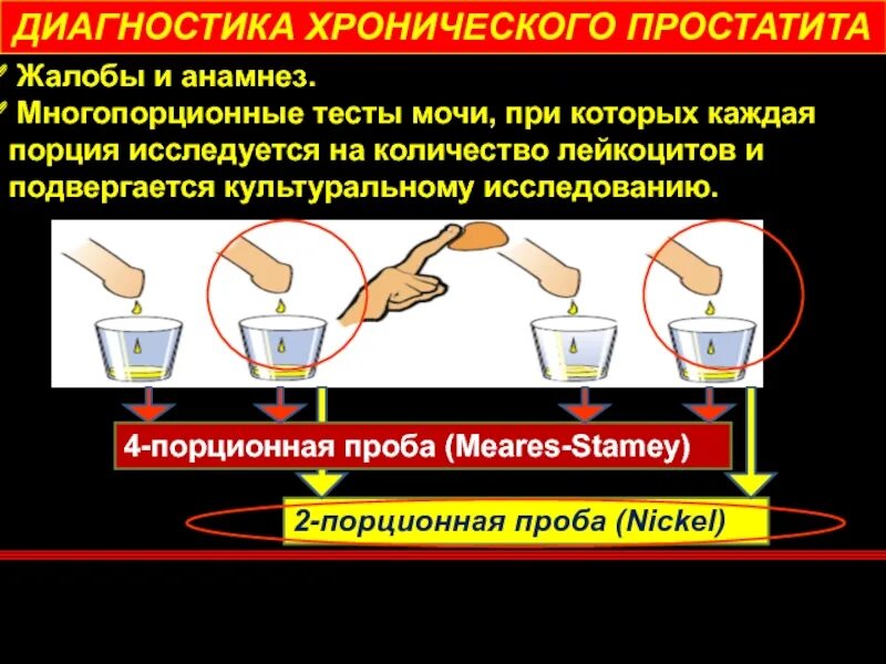 Трехстаканная проба мочи. Проба Stamey Meares. 4 Стаканная проба Meares Stamey. Стаканные пробы мочи. Диагностика простатита.