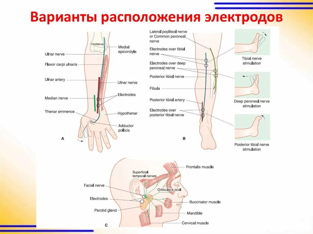 Местоположение электродов при реовазографии голеней. Смт терапия методики наложения электродов. Миостимуляция расположение электродов. Расположение электродов при электрофорезе. Нейропатия лицевого нерва мкб