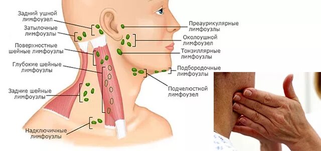 На шее лимфоузлы где расположены у человека