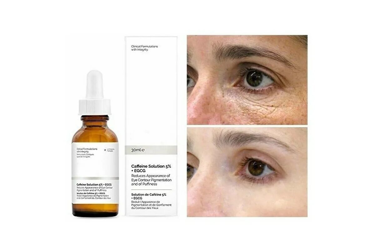 5 solution. Сыворотка the ordinary caffeine solution 5% + egcg. caffeine solution 5 egcg от the ordinary. сыворотка под глаза ordinary. the ordinary под глаза с кофеином.
