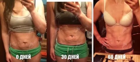 Диастаз до после