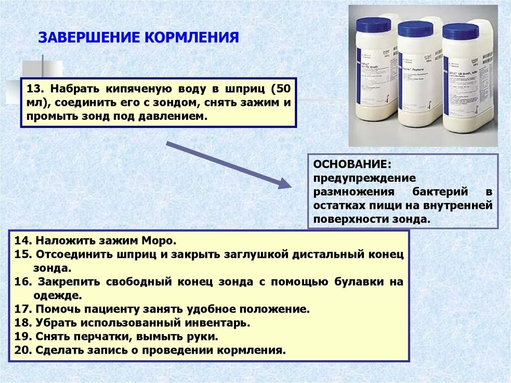 Дистальный конец зонда. Завершение кормления. Дистальный участок зонда. Наложить зажим на дистальный конец зонда.