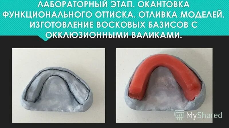Привести в базисы. Восковой Базис с окклюзионными валиками. Восковые базисы с окклюзионными валиками из воска.. Требования к восковым базисам с окклюзионными валиками. Методика изготовления восковых базисов с окклюзионными валиками.
