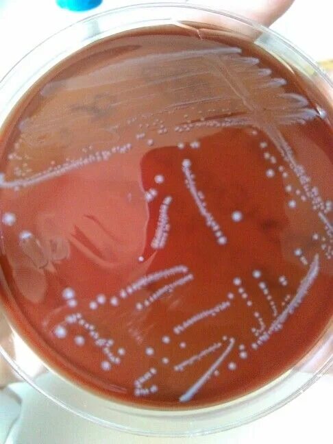 Кишечная палочка энтерококк. Энтерококки микробиология. St. faecalis. Enterococcus faecalis микробиология. Энтерококки фото.