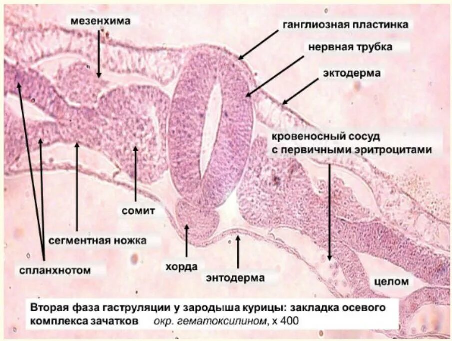 Зачаточное состояние. Мезенхима зародыша курицы препарат. Формирование нервной трубки гистология. Мезенхима зародыша цыпленка гистология. Осевой комплекс зачатков органов гистология.