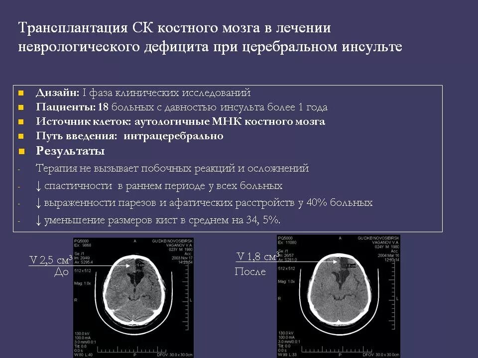 Пересадка костного мозга москва. Трансплантация костного мозга. Трансплантация исследование костного мозга. Недостаточность костного мозга. Лабораторные тесты при пересадке костного мозга.