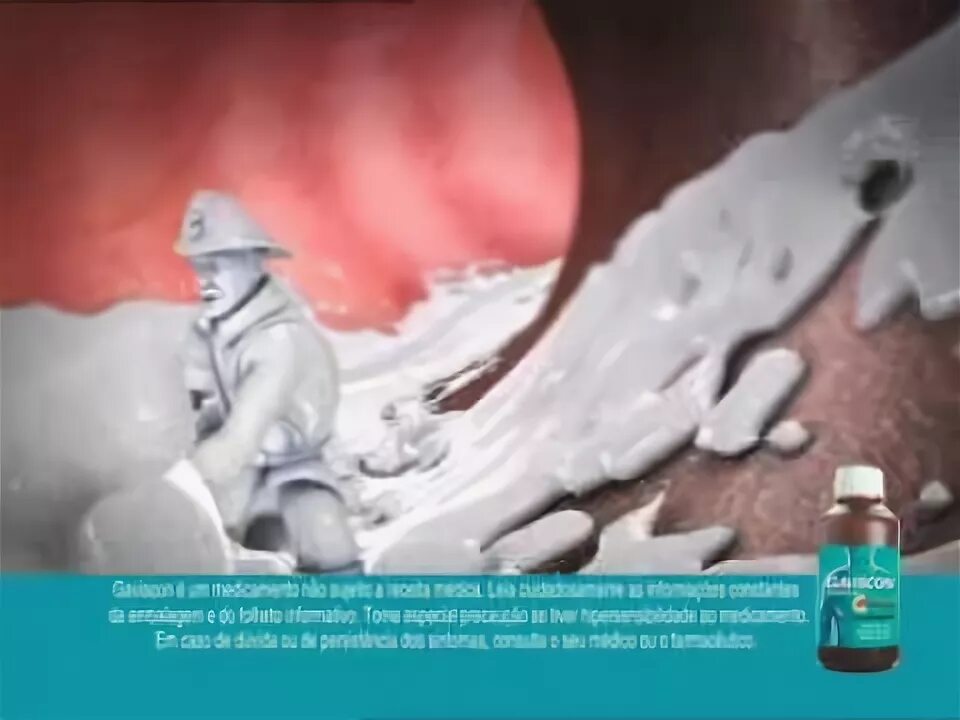 Изжога реклама. Реклама от изжоги. Гевискон реклама. Реклама от изжоги. Реклама от изжоги.