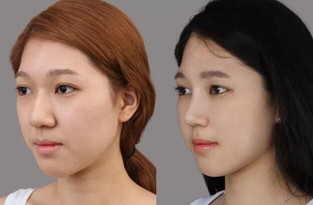 как выглядела корейка раньше. максим матвеев даша. как выглядела корейка раньше. максим матвеев даша корейка. как выглядела корейка раньше.