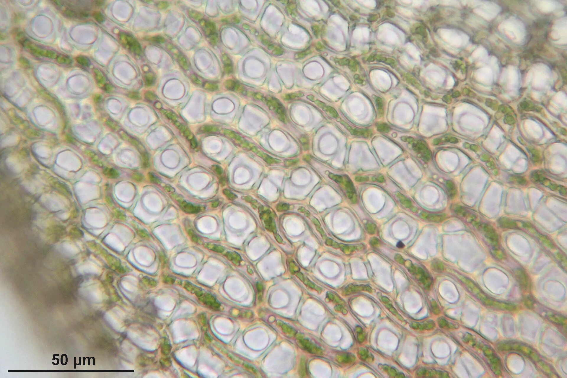 Водоносные клетки в листьях имеет. Клетки сфагнума под микроскопом. Клетки листа сфагнума под микроскопом. Мох сфагнум под микроскопом. Водоносные клетки сфагнума.