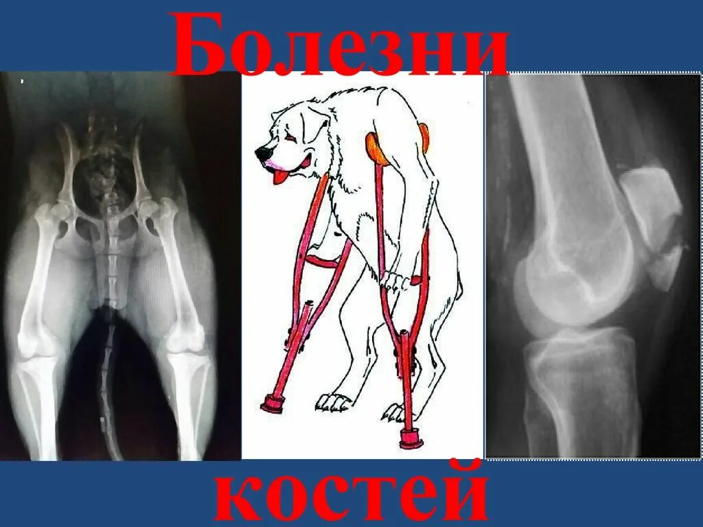 Больные суставы болезнь. Заболевание костных костей. Костно суставные болезни.