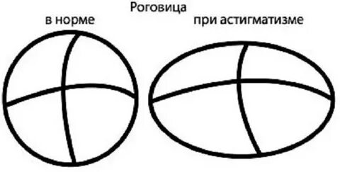 Астигматизм тест нмо с ответами по утвержденным