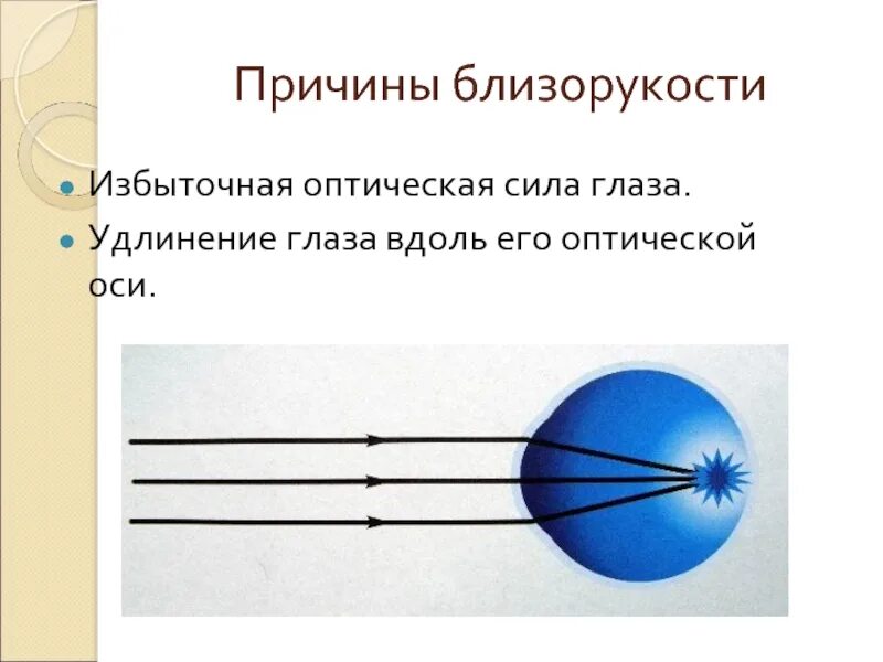 Глаз имеет оптическую силу. Оптическая система глаза. Глаз физика. Оптическая сила глаза с близорукостью. Глаз как оптическая система.