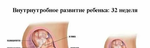 Головная боль в 1 триместре беременности