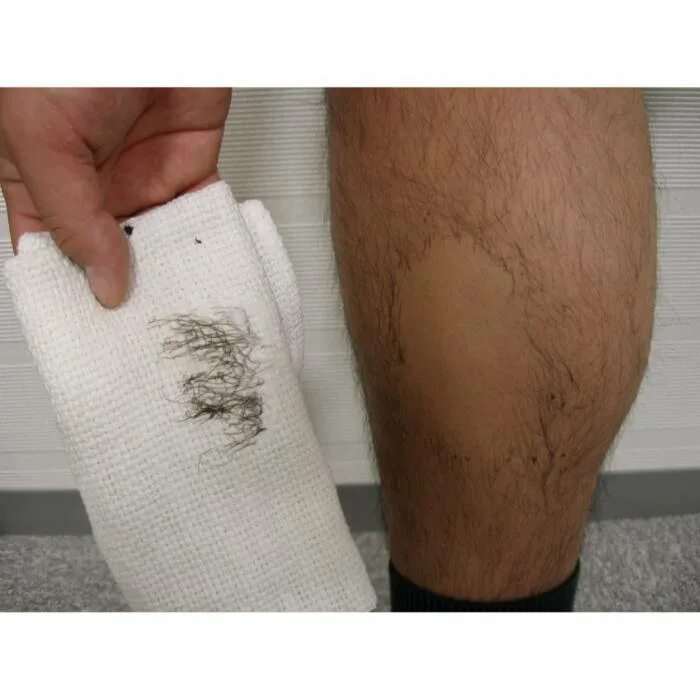 Избавления от волос на ногах. Удалить на ногах навсегда. Удалить волосы на теле навсегда. Избавиться от волос на теле. Избавление от волос навсегда.