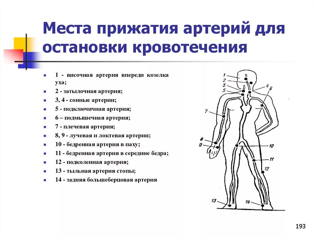 Схема пальцевого прижатия артерий. Точки прижатия артерий при кровотечении схема. Точки пальцевого прижатия для остановки артериального кровотечения. Точки пальцевого прижатия артерий схема.