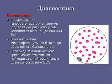 Ретикулоцитоз