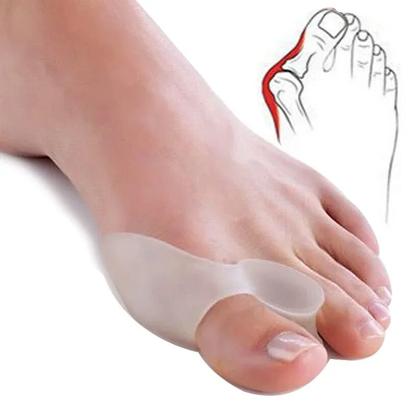 Spread feet. Фиксатор "valgus Pro" (вальгус про). Gel Toe Separator valgus. Гелевый фиксатор valgus Pro. Bunion hallux valgus.