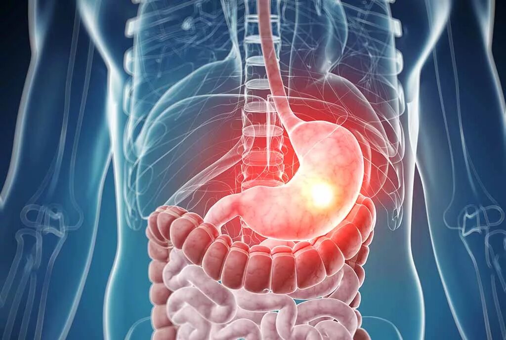 Заболевания пищеварительного тракта. Заболевания органов ЖКТ. Заболевания желудочно-кишечного тракта (ЖКТ). Боли в желудке обследование