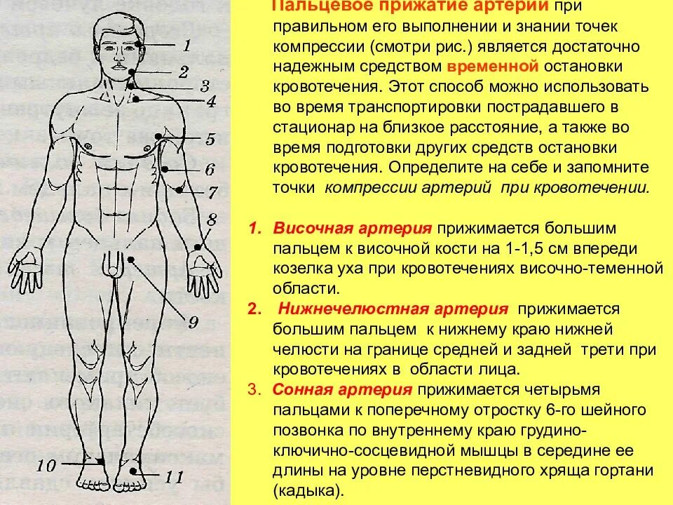 Способы остановки кровотечения пальцевое прижатие артерии. Какова методика остановки кровотечения пальцевым прижатием. Пальцевый метод остановки кровотечения. Методика пальцевого прижатия артерий. Техника пальцевого прижатия при артериальном кровотечении.